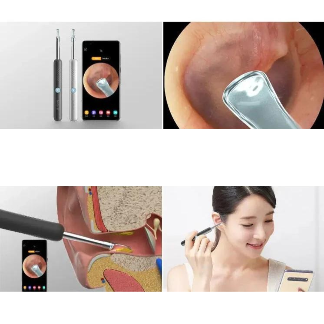 Smart verktyg för öronrengöring