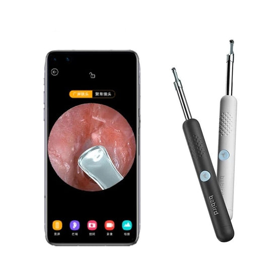 Smart verktyg för öronrengöring