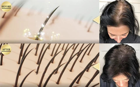 Schampobar för återväxt av rött hår