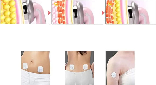 Kroppsslankare Ultraljud Kavitation Maskin