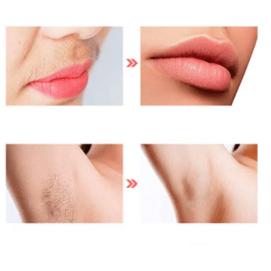 Felfri hårborttagningsmedel